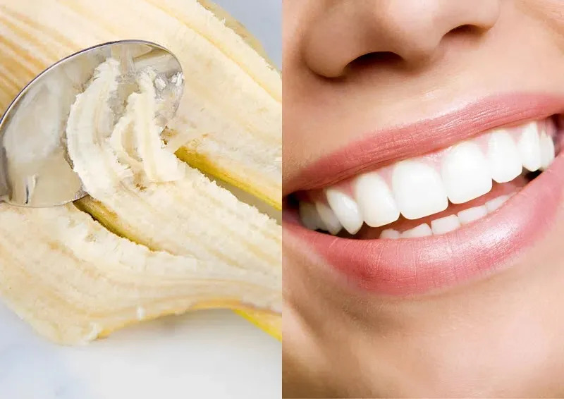 Những mẹo làm trắng răng trong 5 phút hiệu quả cấp tốc